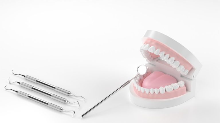 予防歯科の取り組み